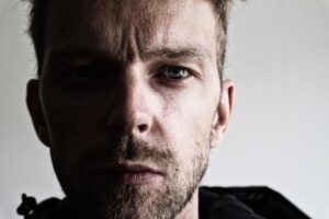 デリケートゾーンの黒ずみ解消に効果的な美白クリームの成分比較は？